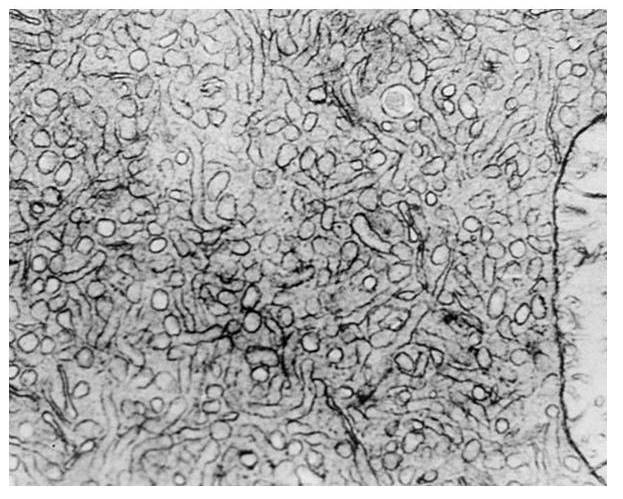 endoplazm2